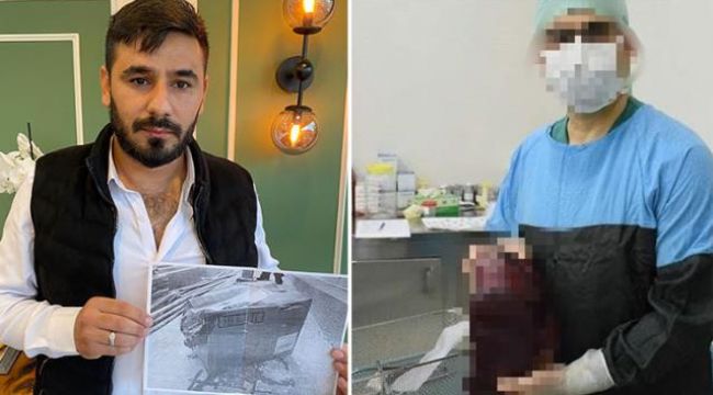 "Kayıp dalak" soruşturmasında idari para cezası aileyi memnun etmedi