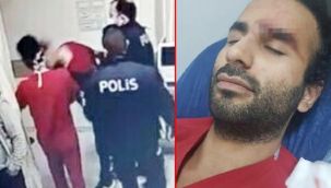 Doktora kafa atan saldırgandan hayrete düşüren savunma