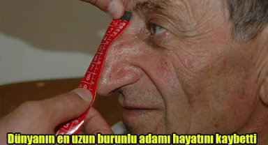 Dünyanın en uzun burunlu adamı hayatını kaybetti